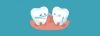 پوسیدگی دندان روکش شده + لیست دندانپزشکان تبریز
