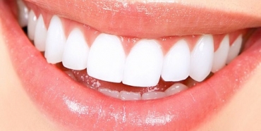 بهترین مارک کامپوزیت دندان ، برندهای کامپوزیت دندان | کامپوزیت دندان در تبریز
